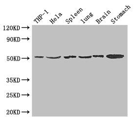 Western Blot Positive WB detected in: THP-1 whole cell lysate, Hela whole cell lysate, Mouse spleen tissue, Mouse lung tissue, Mouse brain tissue, Mouse stomach tissue All lanes: MSR1 antibody at 1.5ug/ml Secondary Goat polyclonal to rabbit IgG at...