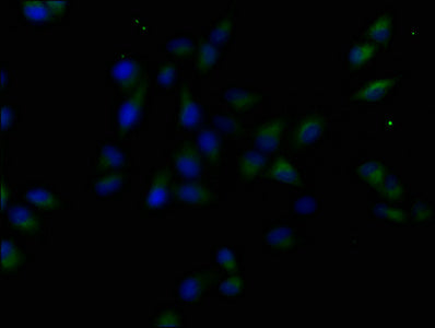 Immunofluorescence staining of Hela cells with CSB-PA015056LA01HU at 1:50, counter-stained with DAPI. The cells were fixed in 4% formaldehyde, permeabilized using 0.2% Triton X-100 and blocked in 10% normal Goat Serum. The cells were then incubate...