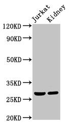 Western Blot Positive WB detected in: Jurkat whole cell lysate, Rat kidney tissue All lanes: MSX2 antibody at 2µg/ml Secondary Goat polyclonal to rabbit IgG at 1/50000 dilution Predicted band size: 29 kDa Observed band size: 29 kDa