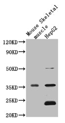 Western Blot Positive WB detected in: Mouse heart tissue, Mouse liver tissue, Mouse kidney tissue, Mouse brain tissue, Mouse skeletal muscle tissue, Mouse stomach tissue All lanes: MTND1 antibody at 3ug/ml Secondary Goat polyclonal to rabbit IgG a...