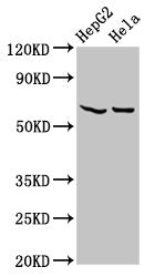 Western Blot Positive WB detected in: HepG2 whole cell lysate, Hela whole cell lysate All lanes: MT-ND5 antibody at 4.6µg/ml Secondary Goat polyclonal to rabbit IgG at 1/50000 dilution Predicted band size: 68 kDa Observed band size: 68 kDa
