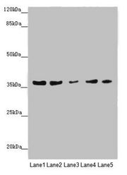 Western blot All lanes: MTHFD2 antibody at 4.99µg/ml Lane 1: 293 whole cell lysate Lane 2: A431 whole cell lysate Lane 3: HepG2 whole cell lysate Lane 4: Hela whole cell lysate Lane 5: K562 whole cell lysate Secondary Goat polyclonal to rabbit IgG...