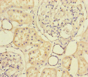 Immunohistochemistry of paraffin-embedded human kidney tissue using CSB-PA015156ESR2HU at dilution of 1:100