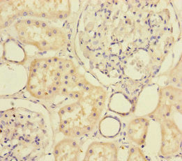 Immunohistochemistry of paraffin-embedded human kidney tissue using CSB-PA015156ESR2HU at dilution of 1:100