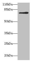 Western blot All lanes: MTHFR antibody at 2µg/ml + 293T whole cell lysate Secondary Goat polyclonal to rabbit IgG at 1/10000 dilution Predicted band size: 75, 79 kDa Observed band size: 75 kDa