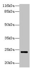 Western blot All lanes: MTHFS antibody at 2µg/ml + Hela whole cell lysate Secondary Goat polyclonal to rabbit IgG at 1/10000 dilution Predicted band size: 24, 21 kDa Observed band size: 24 kDa