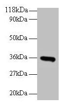 Western blot All lanes: CYC1 antibody at 2µg/ml + EC109 whole cell lysate Secondary Goat polyclonal to rabbit IgG at 1/15000 dilution Predicted band size: 36 kDa Observed band size: 36 kDa