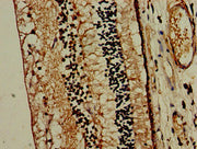 Immunohistochemistry of paraffin-embedded human eye tissue using CSB-PA015190LA01HU at dilution of 1:100