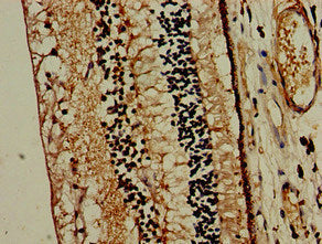 Immunohistochemistry of paraffin-embedded human eye tissue using CSB-PA015190LA01HU at dilution of 1:100