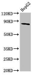 Western Blot Positive WB detected in: HepG2 whole cell lysate All lanes: MTSS1 antibody at 3.84ug/ml Secondary Goat polyclonal to rabbit IgG at 1/50000 dilution Predicted band size: 83, 51, 80 kDa Observed band size: 83 kDa