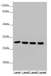 Western blot All lanes: MTX2 antibody at 4.53 ug/ml Lane 1: Mouse heart tissue Lane 2: Mouse kidney tissue Lane 3: Jurkat whole cell lysate Lane 4: Mouse liver tissue Secondary Goat polyclonal to rabbit IgG at 1/10000 dilution Predicted band size:...