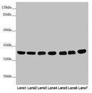 Western blot All lanes: MTX2 antibody at 3.79 ug/ml Lane 1: Mouse heart tissue Lane 2: Mouse kidney tissue Lane 3: Mouse liver tissue Lane 4: Jurkat whole cell lysate Lane 5: MCF-7 whole cell lysate Lane 6: HepG2 whole cell lysate Lane 7: 293T who...