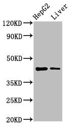 Western Blot Positive WB detected in: HepG2 whole cell lysate, Rat liver tissue All lanes: MVD antibody at 7.4µg/ml Secondary Goat polyclonal to rabbit IgG at 1/50000 dilution Predicted band size: 44 kDa Observed band size: 44 kDa