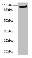 Western blot All lanes: MVP antibody at 2µg/ml + Rat lung tissue Secondary Goat polyclonal to rabbit IgG at 1/10000 dilution Predicted band size: 100 kDa Observed band size: 110 kDa