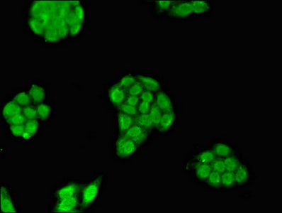Immunofluorescent analysis of PC-3 cells using CSB-PA015254LA01HU at dilution of 1:100 and Alexa Fluor 488-congugated AffiniPure Goat Anti-Rabbit IgG(H+L)