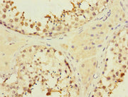 Immunohistochemistry of paraffin-embedded human testis tissue using CSB-PA015263ESR1HU at dilution of 1:100