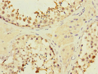 Immunohistochemistry of paraffin-embedded human testis tissue using CSB-PA015263ESR1HU at dilution of 1:100