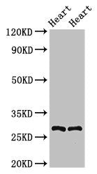 Western Blot Positive WB detected in: Rat heart tissue, Mouse heart tissue All lanes: MYF5 antibody at 2.5ug/ml Secondary Goat polyclonal to rabbit IgG at 1/50000 dilution Predicted band size: 29 kDa Observed band size: 29 kDa