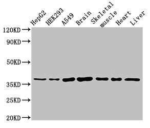 Western Blot Positive WB detected in: HepG2 whole cell lysate, HEK293 whole cell lysate, A549 whole cell lysate, Mouse brain tissue, Mouse skeletal muscle tissue, Rat heart tissue, Rat liver tissue All lanes: MYF6 antibody at 3µg/ml Secondary Goat...