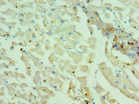 Immunohistochemistry of paraffin-embedded human heart tissue using CSB-PA015289ESR1HU at dilution of 1:100