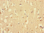Immunohistochemistry of paraffin-embedded human brain tissue using CSB-PA015297LA01HU at dilution of 1:100