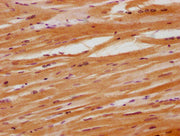 IHC image of CSB-PA015299HA01HU diluted at 1:100 and staining in paraffin-embedded human heart tissue performed on a Leica BondTM system. After dewaxing and hydration, antigen retrieval was mediated by high pressure in a citrate buffer (pH 6.0). S...