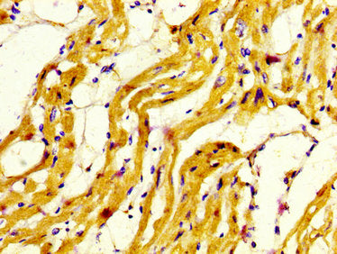 IHC image of CSB-PA015300LA01HU diluted at 1:800 and staining in paraffin-embedded human heart tissue performed on a Leica BondTM system. After dewaxing and hydration, antigen retrieval was mediated by high pressure in a citrate buffer (pH 6.0). S...