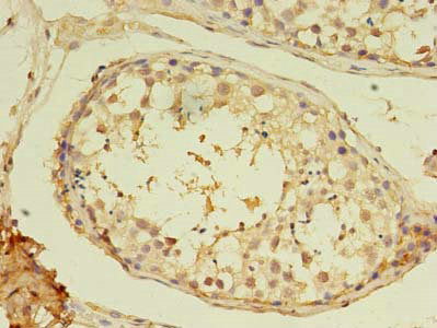 Immunohistochemistry of paraffin-embedded human testis tissue using CSB-PA015301LA01HU at dilution of 1:100