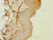 Immunohistochemistry of paraffin-embedded human skin tissue using CSB-PA015305DSR1HU at dilution of 1:100