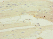 Immunohistochemistry of paraffin-embedded human skeletal muscle tissue using CSB-PA015305DSR2HU at dilution of 1:100