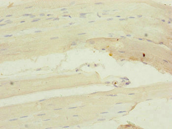 Immunohistochemistry of paraffin-embedded human skeletal muscle tissue using CSB-PA015305DSR2HU at dilution of 1:100