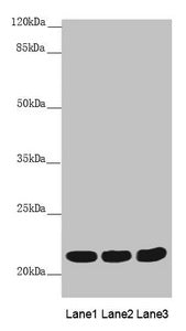 Western blot All lanes: MYL3 antibody at 3.78 ug/ml Lane 1: Mouse heart tissue Lane 2: Mouse skeletal muscle tissue Lane 3: Rat heart tissue Secondary Goat polyclonal to rabbit IgG at 1/10000 dilution Predicted band size: 22 kDa Observed band size...