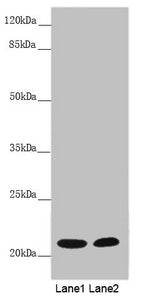 Western blot All lanes: MYL3 antibody at 5.17 ug/ml Lane 1: Mouse heart tissue Lane 2: Rat heart tissue Secondary Goat polyclonal to rabbit IgG at 1/10000 dilution Predicted band size: 22 kDa Observed band size: 22 kDa