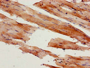 Immunohistochemistry of paraffin-embedded human skeletal muscle tissue using CSB-PA015318LA01HU at dilution of 1:100
