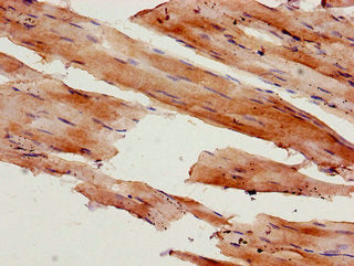 Immunohistochemistry of paraffin-embedded human skeletal muscle tissue using CSB-PA015318LA01HU at dilution of 1:100