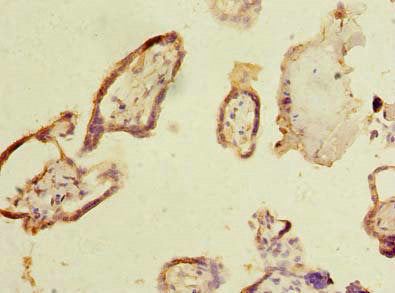 Immunohistochemistry of paraffin-embedded human placenta tissue using CSB-PA015330LA01HU at dilution of 1:100