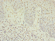 Immunohistochemistry of paraffin-embedded human tonsil tissue using CSB-PA015340ESR2HU at dilution of 1:100