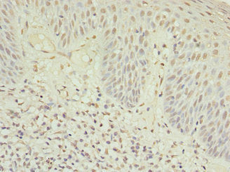 Immunohistochemistry of paraffin-embedded human tonsil tissue using CSB-PA015340ESR2HU at dilution of 1:100