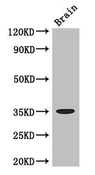 Western Blot Positive WB detected in: Mouse brain tissue All lanes: MYOD1 antibody at 3ug/ml Secondary Goat polyclonal to rabbit IgG at 1/50000 dilution Predicted band size: 35 kDa Observed band size: 35 kDa