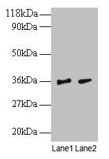 Western blot All lanes: SNRPG antibody at 2µg/ml Lane 1: EC109 whole cell lysate Lane 2: 293T whole cell lysate Secondary Goat polyclonal to rabbit IgG at 1/15000 dilution Predicted band size: 9 kDa Observed band size: 36 kDa
