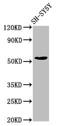 Western Blot Positive WB detected in: SH-SY5Y whole cell lysate All lanes: MZF1 antibody at 7.7µg/ml Secondary Goat polyclonal to rabbit IgG at 1/50000 dilution Predicted band size: 83, 55, 32 kDa Observed band size: 55 kDa