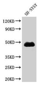 Western Blot Positive WB detected in: SH-SY5Y whole cell lysate All lanes: NADK antibody at 1.7µg/ml Secondary Goat polyclonal to rabbit IgG at 1/50000 dilution Predicted band size: 50, 64, 47 kDa Observed band size: 47 kDa
