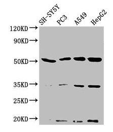 Western Blot Positive WB detected in: SH-SY5Y whole cell lysate, PC-3 whole cell lysate, A549 whole cell lysate, HepG2 whole cell lysate All lanes: NAGPA antibody at 3.2µg/ml Secondary Goat polyclonal to rabbit IgG at 1/50000 dilution Predicted ba...
