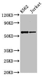 Western Blot Positive WB detected in: K562 whole cell lysate, Jurkat whole cell lysate All lanes: NAMPT antibody at 2.7µg/ml Secondary Goat polyclonal to rabbit IgG at 1/50000 dilution Predicted band size: 56 kDa Observed band size: 56 kDa