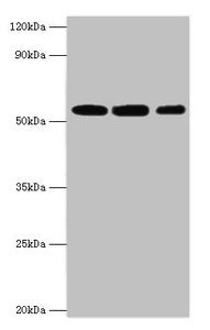 Western blot All lanes: Nicotinamide phosphoribosyltransferase antibody at 4ug/ml Lane 1: Mouse heart tissue Lane 2: Mouse liver tissue Lane 3: Mouse skeletal muscle tissue Secondary Goat polyclonal to rabbit IgG at 1/10000 dilution Predicted band...