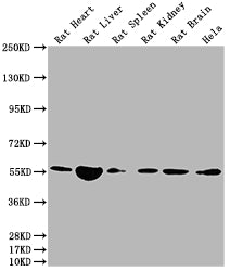 Western Blot Positive WB detected in: Rat Heart tissue, Rat Liver tissue, Rat Spleen tissue, Rat Kidney tissue, Rat Brain tissue, Hela whole cell lysate All lanes: Nampt antibody at 1:2000 Secondary Goat polyclonal to rabbit IgG at 1/50000 dilutio...