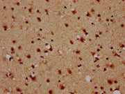 IHC image of CSB-PA015445LA01HU diluted at 1:600 and staining in paraffin-embedded human brain tissue performed on a Leica BondTM system. After dewaxing and hydration, antigen retrieval was mediated by high pressure in a citrate buffer (pH 6.0). S...