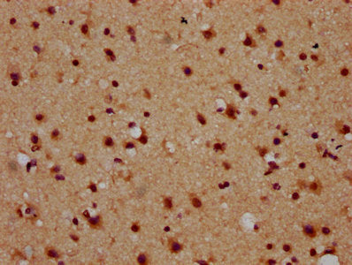 IHC image of CSB-PA015445LA01HU diluted at 1:600 and staining in paraffin-embedded human brain tissue performed on a Leica BondTM system. After dewaxing and hydration, antigen retrieval was mediated by high pressure in a citrate buffer (pH 6.0). S...