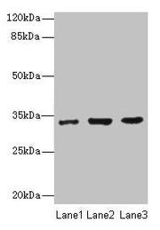 Western blot All lanes: NAPA antibody at 7µg/ml Lane 1: 293T whole cell lysate Lane 2: Hela whole cell lysate Lane 3: K562 whole cell lysate Secondary Goat polyclonal to rabbit IgG at 1/10000 dilution Predicted band size: 34 kDa Observed band size...