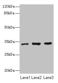 Western blot All lanes: NAPA antibody at 7µg/ml Lane 1: 293T whole cell lysate Lane 2: Hela whole cell lysate Lane 3: K562 whole cell lysate Secondary Goat polyclonal to rabbit IgG at 1/10000 dilution Predicted band size: 34 kDa Observed band size...